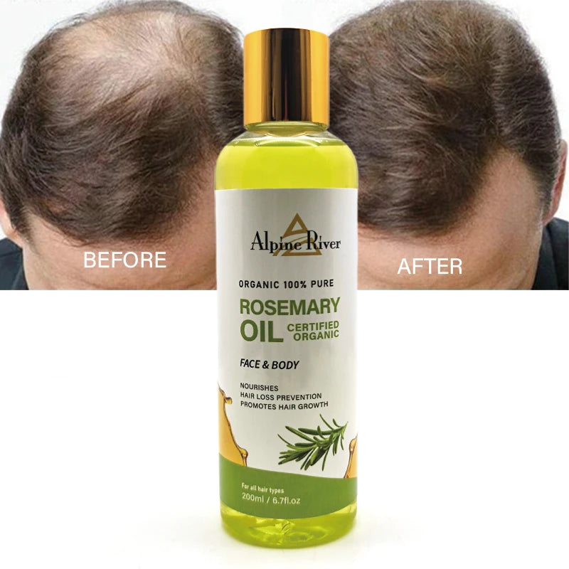 Rosemary Hair Growth Oil
